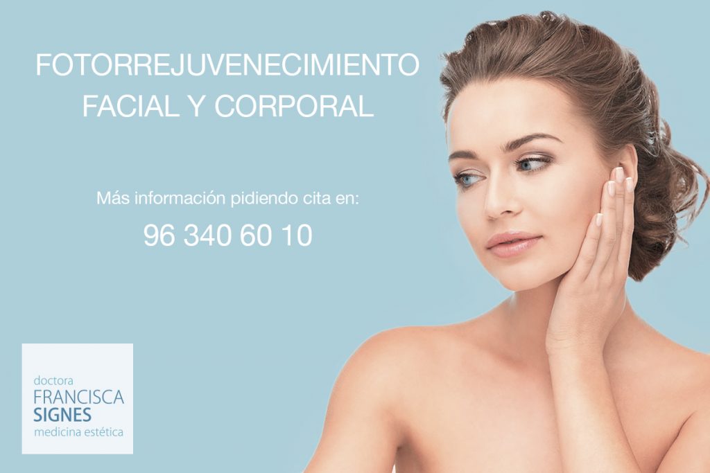 fotorrejuvenecimeinto